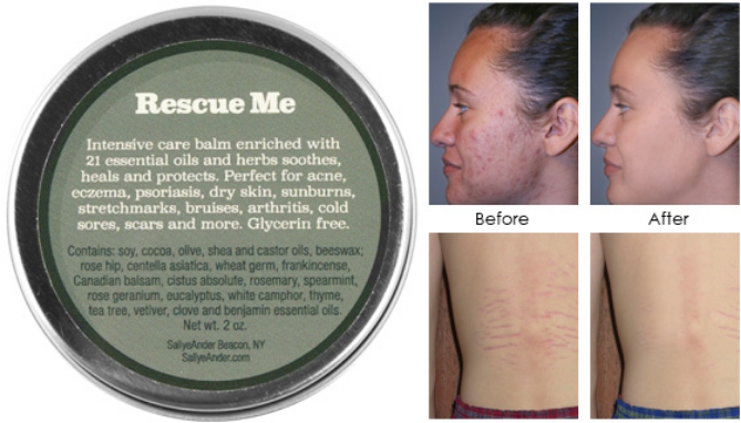 Picture 3 of Rescue Me - Intensive Care Balm for Distressed Skin
